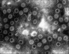 感染性腹泻病