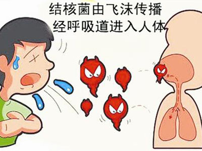 结核病
